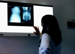 women looking at x-ray for medical malpractice