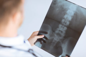  medical malpractice lawyer in Philadelphia