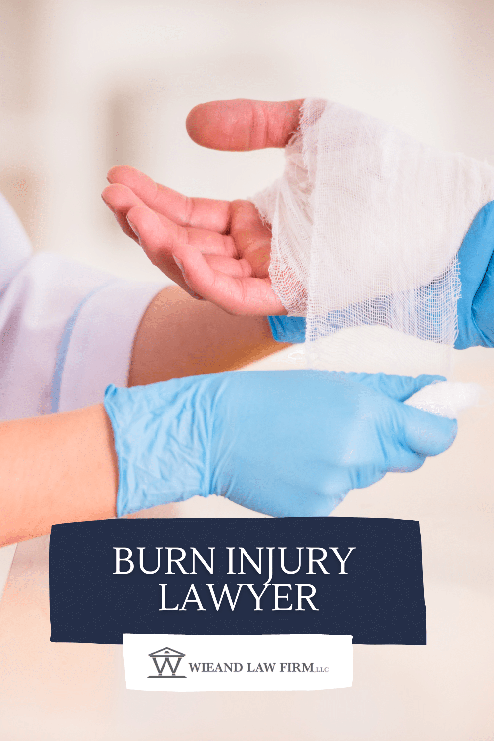 Burn Injury Compensation Payouts Norwalk thumbnail