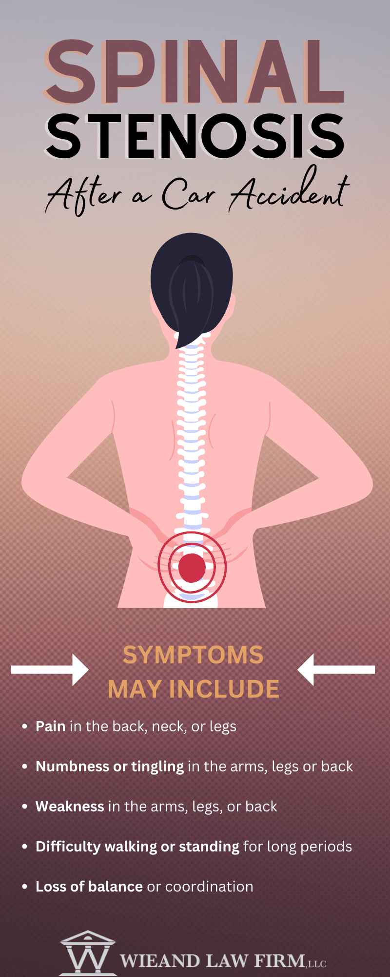 Ask a Philadelphia Car Accident Lawyer: Can A Car Accident Cause Spinal  Stenosis? - Wieand Law Firm